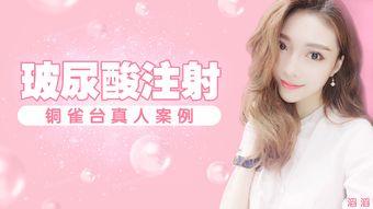 整形爆料视频大全下载,热门爆料视频大全下载解析